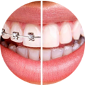 Dental Cerec