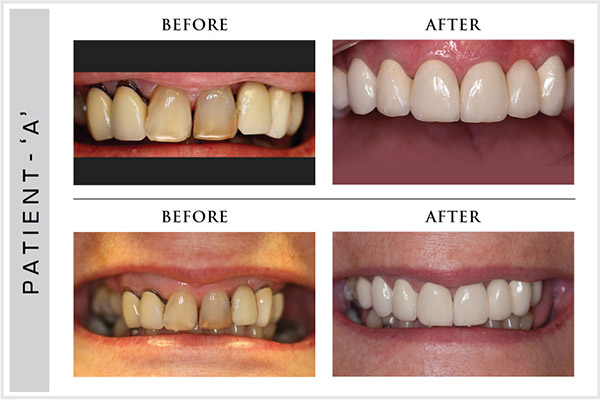 Smile Design, Sensura Dental