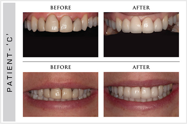 Smile Design, Sensura Dental