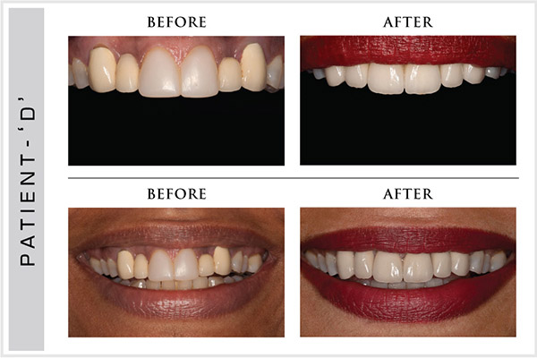 Smile Design, Sensura Dental