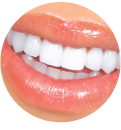 Dental Veneers